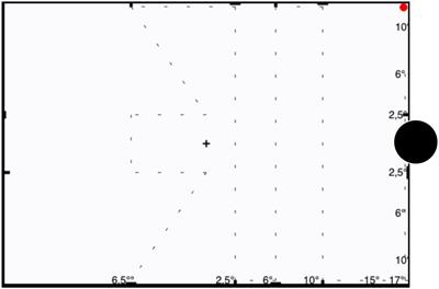 Rapid campimetry - a novel robust kinetic approach for visual field screening in glaucoma